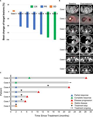 Anti-Angiogenic Agent Combined with Anti-PD-1 Immunotherapy Showed Activity in Patients With Classical Hodgkin Lymphoma Who Have Failed Immunotherapy: A Retrospective Case Report Study